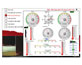 Meteo-et-webcam-zoom-meteo [ www.lachaloupe-iledere.fr ]